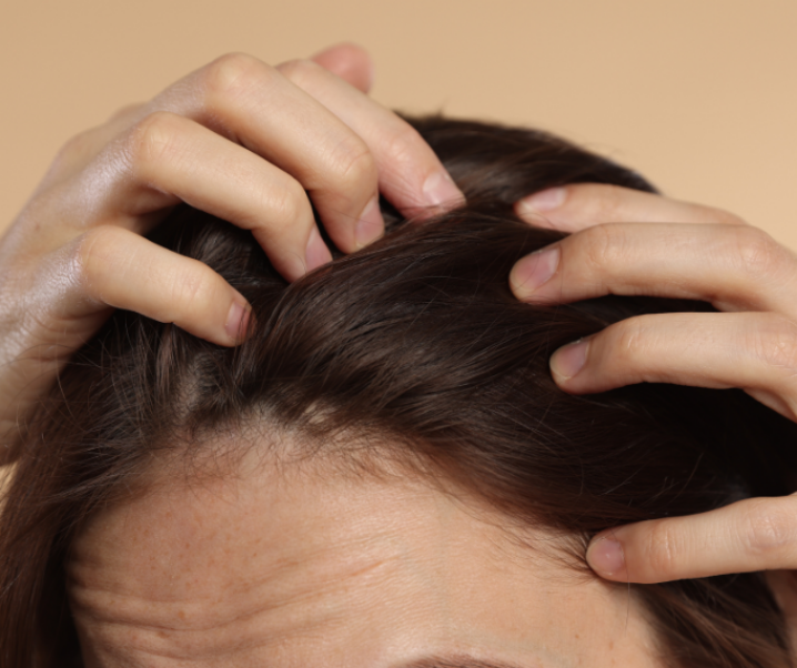 Vous avez le cuir chevelu sensible ? Le shampoing à l’huile de cade le soulage naturellement !